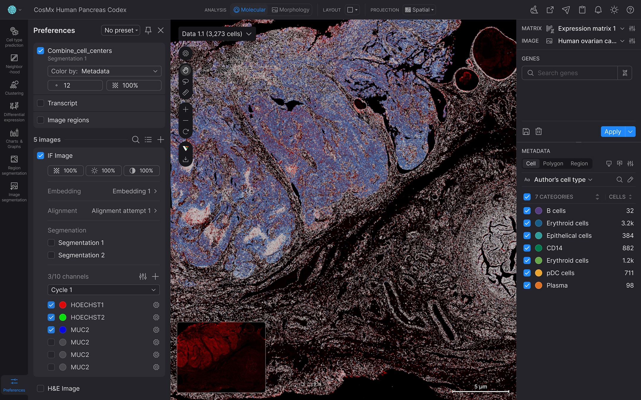 SpatialX cover image